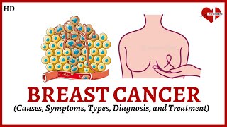 Overview of Breast Cancer Causes Symptoms Types and Treatment Explained [upl. by Andriette]