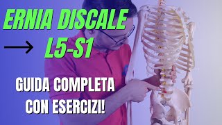 Ernia L5S1 GUIDA COMPLETA CON ESERCIZI [upl. by Nuzzi]