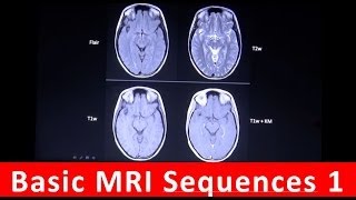 Basic MRI sequences Part 1 by Radiology TV [upl. by Albright]