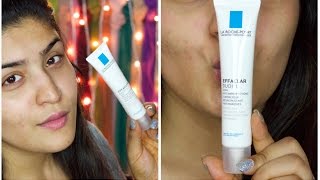 La Roche Posay Effaclar Duo Review  How I faded my acne scars [upl. by Mandel51]