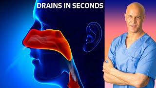 Dr Mandells Sinus Drainage Trick [upl. by Coffin]