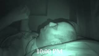 Snore RX Stop Snoring Mouthpiece Review Live Results [upl. by Warila538]