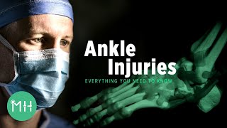 Ankle Injuries  Everything you need to know [upl. by Okram659]