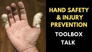 Hand Safety And Injury Prevention Toolbox Talk [upl. by Helbonia]