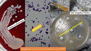 Staphylococcus aureus golden yellow colonies Gram stain Coagulase test Growth on MSA and AST [upl. by Averyl]