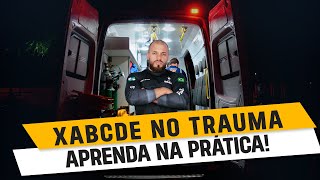 XABCDE no trauma APRENDA NA PRÁTICA [upl. by Melamed]