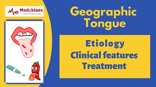 Geographic tongue Benign Migratory Glossitis [upl. by Noda]