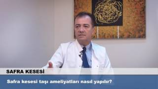 Safra kesesi taşı ameliyatları nasıl yapılır [upl. by Horbal]