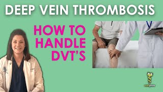 FAQs about Deep Venous Thrombosis DVT  Yashoda Hospitals [upl. by Janeczka]