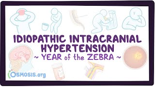 Idiopathic intracranial hypertension Year of the Zebra [upl. by Hulen482]