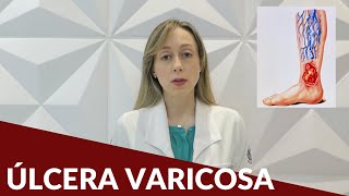 Úlcera varicosa  Dra Nayara Cioffi Batagini  Cirurgia Vascular e Endovascular [upl. by Worth]