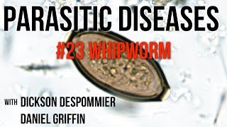 Parasitic Diseases Lectures 23 Whipworm [upl. by Merwyn]