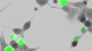 Telight QPhaseVesicular stomatitis virusGFP labeled [upl. by Adnohryt]