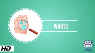 Wart Causes Signs and Symptoms Causes Diagnosis and Treatment [upl. by Asseral]