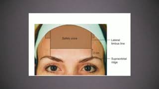 Chapter 1Botox injections in forehead [upl. by Yemarej571]