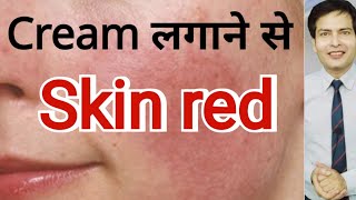 cream लगाने से Skin Red हो गयी [upl. by Ary709]