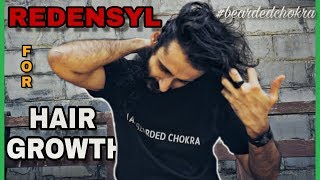 Redensyl For Hair Growth  Is It Better Than Minoxidil  Bearded Chokra [upl. by Airenahs]