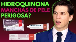 HIDROQUINONA para MANCHAS de Pele COMO USAR Clareadores Suavicid Hormoskin Vitacid Plus [upl. by Nura733]