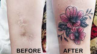 Scar Cover up by a Tattoo  Cover your old scars with a Tattoo  Before and after of an old scar [upl. by Ylekalb524]