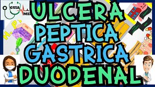 ÚLCERA PÉPTICA GÁSTRICA Y DUODENAL  GuiaMed [upl. by King]