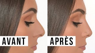 MA RHINOPLASTIE  AVANTAPRÈS PRIX EXPÉRIENCE etc│PerfectHonesty [upl. by Newo]