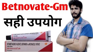 Betnovate gm cream review in hindi [upl. by Ahsikyw]