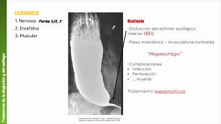 Cap 66 Fisiología de los trastornos gastrointestinales [upl. by Rosaleen]