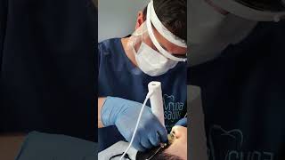 Istanbul Bayrampasa Root Canal treatment  KanalTedavisi dişhekimi rootcanaltherapy health [upl. by Klara19]