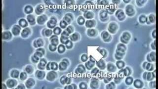 Live Blood Microscopy Demonstration Part 1 [upl. by Urina]