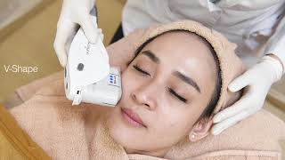 GLOWDERMA SKIN amp LASER CLINIC [upl. by Ahsiugal]