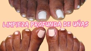 🛑 Limpieza de las uñas de los pies Paso a Paso PedicuraEmbelle Ser aprendiendo uñas [upl. by Notsag]