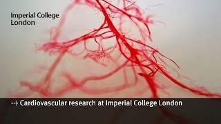 Cardiovascular research at Imperial College London [upl. by Bowe]