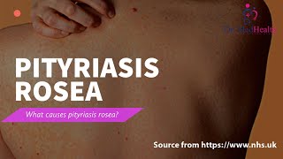 All about pityriasis rosea  causes symptoms pityriasis  pityriasis rosea treatment [upl. by Philly143]