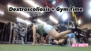 Exercises Good For My Dextroscoliosis  ALYDIGITV [upl. by Ecinnahs]