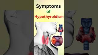 Symptoms of Hypothyoidism [upl. by Eimmelc]