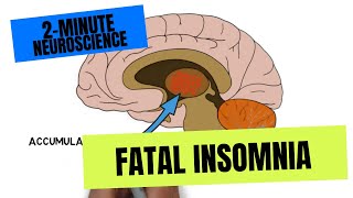 2Minute Neuroscience Fatal Insomnia [upl. by Padraic133]