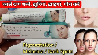 Hydroquinone Tretinoin amp Mometasone Furoate Cream  ELOSONE HT Forte Cream Use amp Sides Effects [upl. by Halsey]