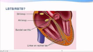 Introductiecursus ECG interpretatie [upl. by Crandale]