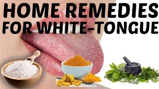 Easy Home Remedies to Get Rid of White Coated Tongue [upl. by Genia]