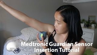 MEDTRONIC GUARDIAN SENSOR INSERTION TUTORIAL [upl. by Megen]