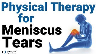 Meniscus Tears Part 1  How can physical therapy help you avoid knee surgery [upl. by Nageem]