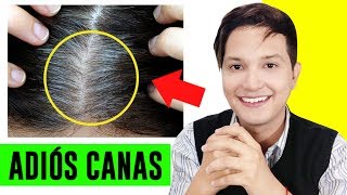 COMO ELIMINAR LAS CANAS NATURALMENTE CON REMEDIOS CASEROS  AndyZarturno [upl. by Kurtzig783]