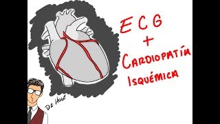 INFARTOS Y ECG COMO NADIE TE LO HA EXPLICADO [upl. by Winnifred]