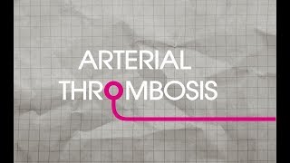 Arterial Thrombosis Explained [upl. by Illac54]