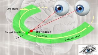 What is Fixation Disparity  Sub  ENG   Fixation Disparity part1 [upl. by Oniuqa302]