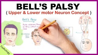 Bells palsy Upper and Lower Motor Neuron Lesions  Simplified [upl. by Ramah842]