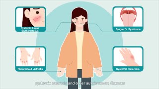 APS and the diagnosis [upl. by Sutton]