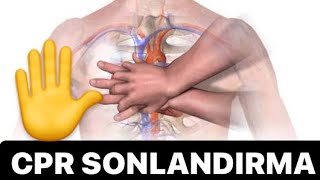 KARDİYOPULMONER RESÜSİTASYON SONLANDIRMA KRİTERLERİ [upl. by Ydnew]