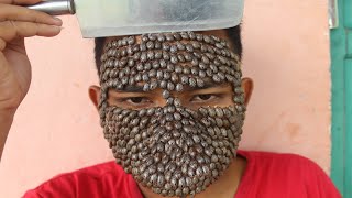 We Help Cleaning Million Big Ticks on Face Man With Knife That Work 100 829 [upl. by Akimad]