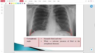 Radiology Lec 2 [upl. by Auhesoj106]